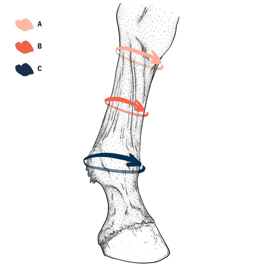 Stübben Compressie Kousen